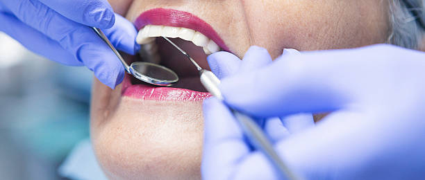 Best Emergency Root Canal Treatment in Mansfield, LA